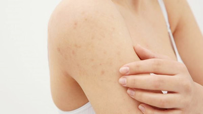 长春哪个治疗皮肤过敏的医院好